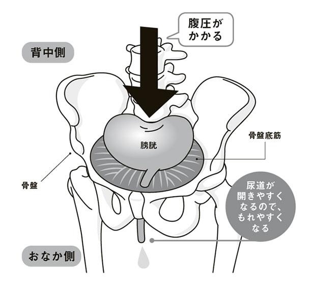 尿がもれるしくみ