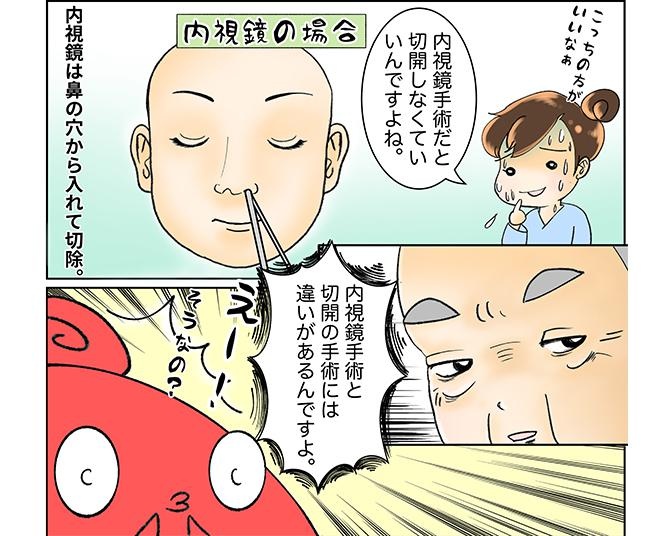 漫画】鼻腔ガンになった話(2ページ目)｜ウォーカープラス