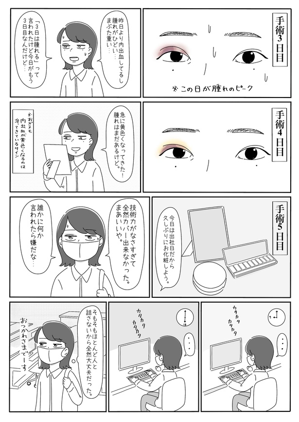 「目整形」21