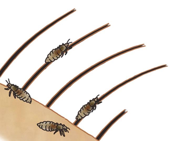 昆虫ハンター・牧田習が解説するオドロキの昆虫雑学！アタマジラミは人間の清潔具合により、増えたり減ったりしている