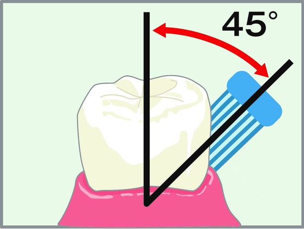 正しい歯磨きは、まず歯と歯肉の境目に45度の角度であてる