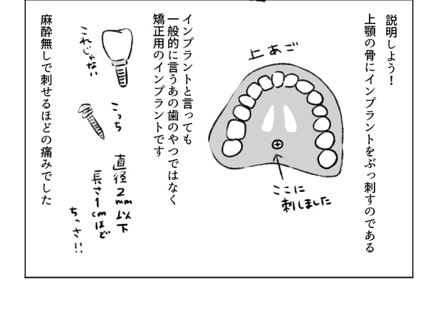 画像36 / 54＞大人になって100万円で歯列矯正したエッセイ漫画に「私も