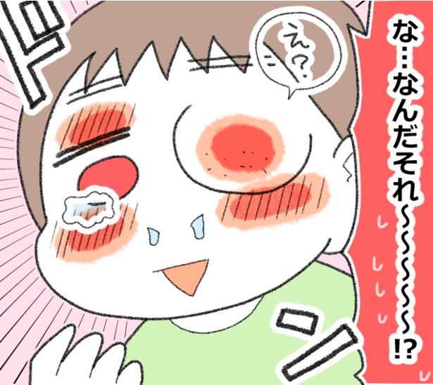アレルギーで顔が腫れた