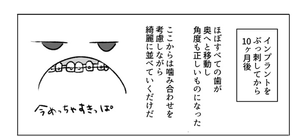 「歯の矯正で人生が変わるエッセイ」38/50