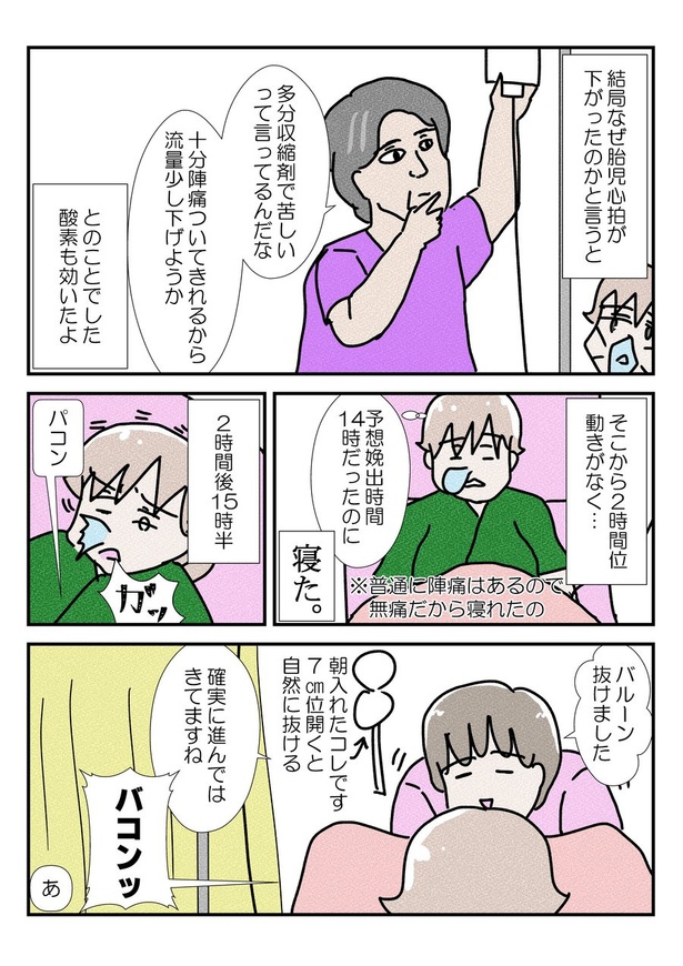 三人目の無痛分娩レポだよ11-1