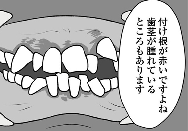 「自分を好きになるために、歯並びを治してみた　～5年5か月100万円！大人の歯列矯正物語～」13話より