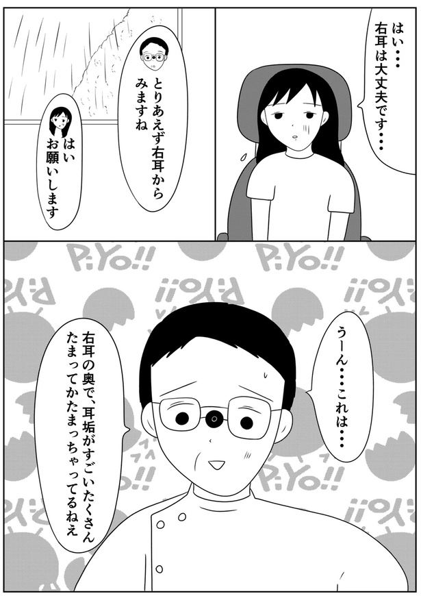 左耳が聞こえづらくなり耳鼻科に行ったら衝撃的だった話06