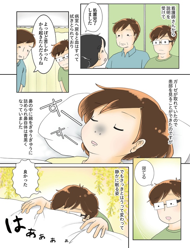 続鼻腔ガンになった話 4話_14