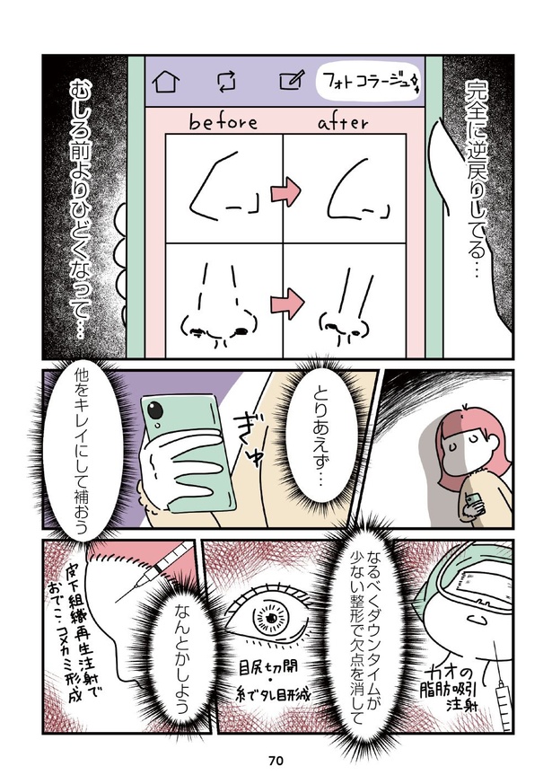 「14歳で整形した私」70