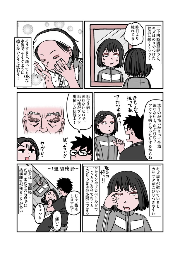 目が重たくてツラい病気『眼瞼下垂』を治したら、色々ラクになったお話24