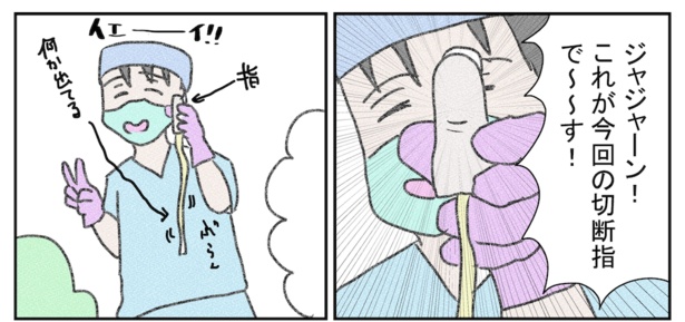指(5)