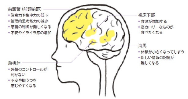 睡眠不足は脳のパフォーマンスに直結