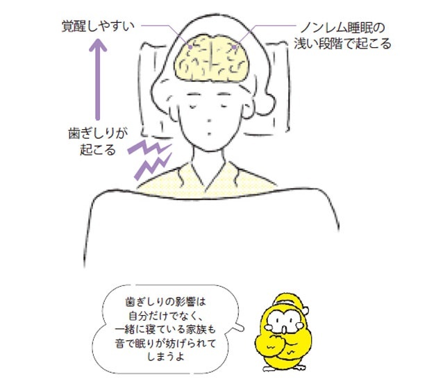 歯ぎしりは睡眠の質を下げる