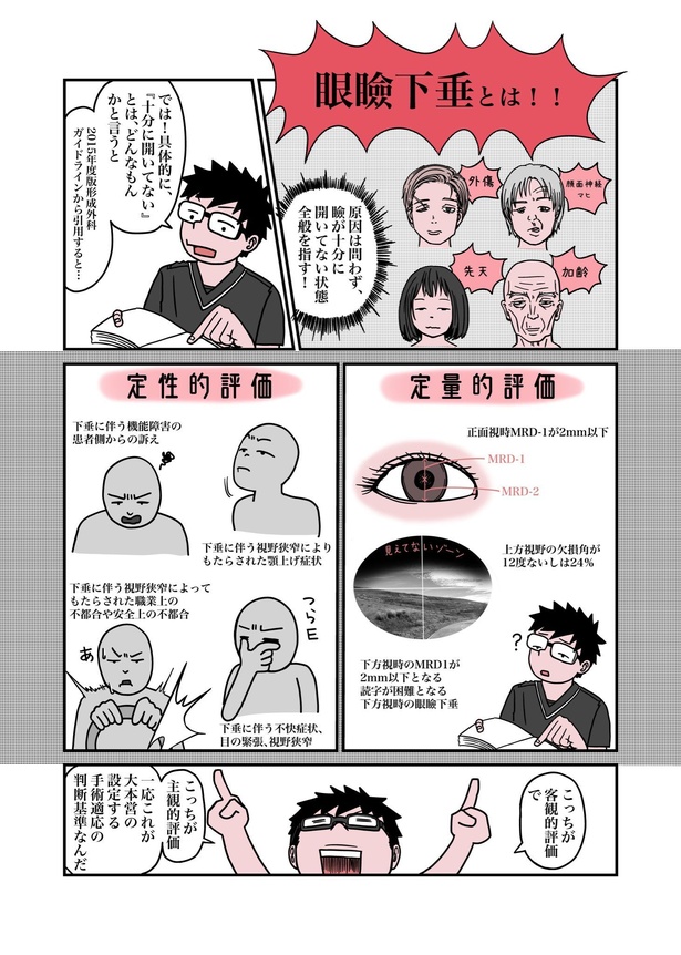 目が重たくてツラい病気『眼瞼下垂』を治したら、色々ラクになったお話06