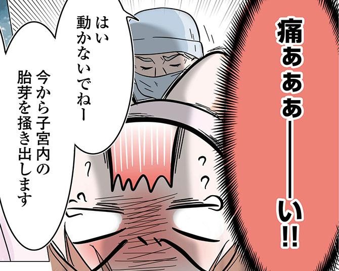 葛藤の末に迎えた減胎手術当日。“麻酔なし”の手術であまりの痛みに悶絶…術後にあふれた感情とは【作者に聞く】