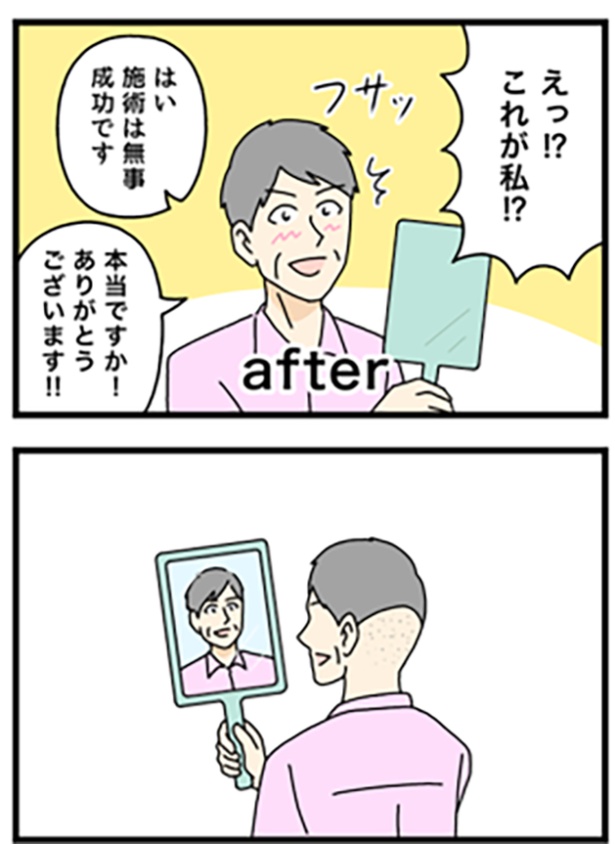 薄毛治療1-2