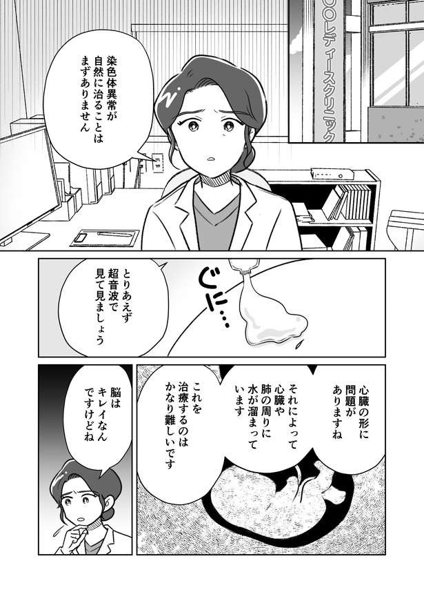 死産3話_006