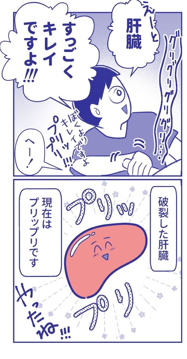 「内臓破裂メモリー」35