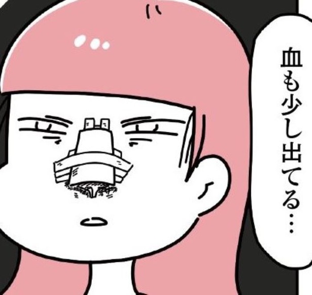 ひとつきれいにすると、他のパーツが醜く見え、ここもそこもと「整形沼」に陥ってしまう
