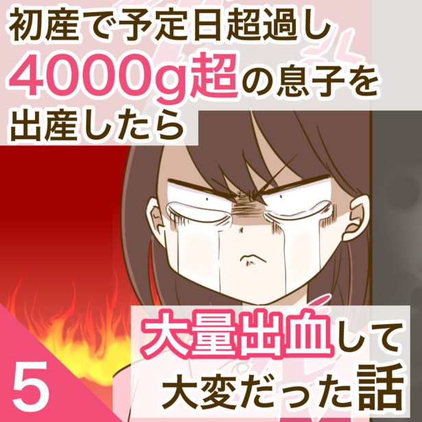 5-1