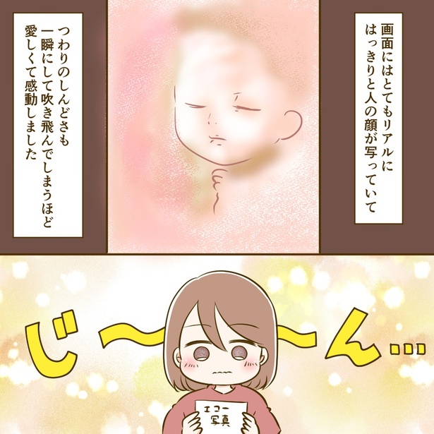 5-4
