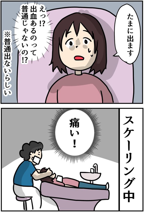 歯の出血は普通ではない!? 9-2