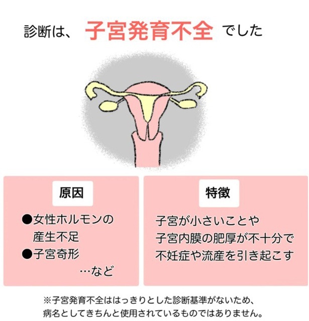 4-3