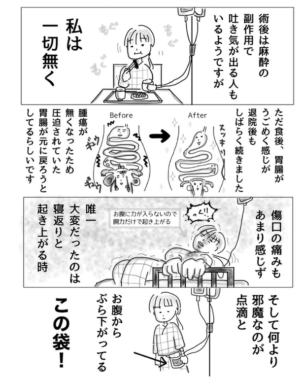 子宮内膜症で入院した時の話9-1