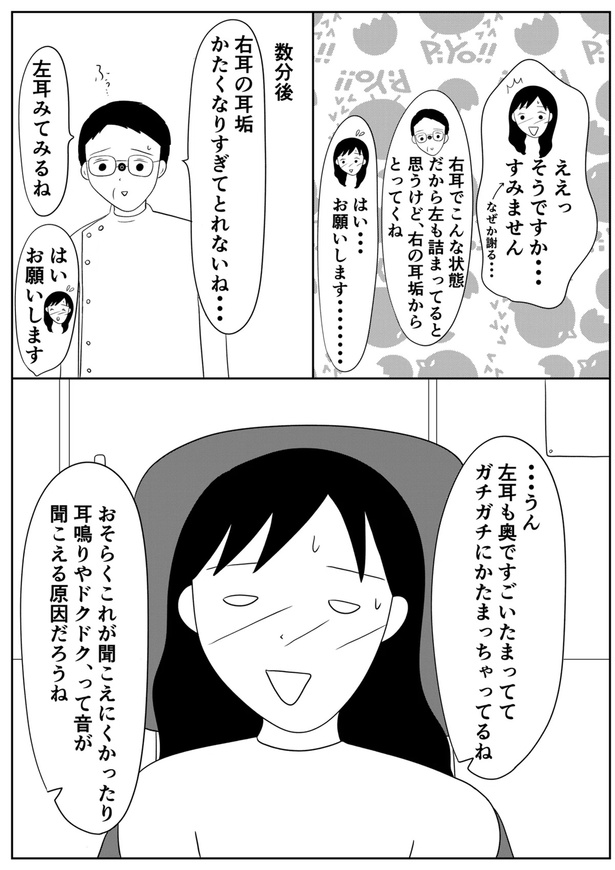 左耳が聞こえづらくなり耳鼻科に行ったら衝撃的だった話07
