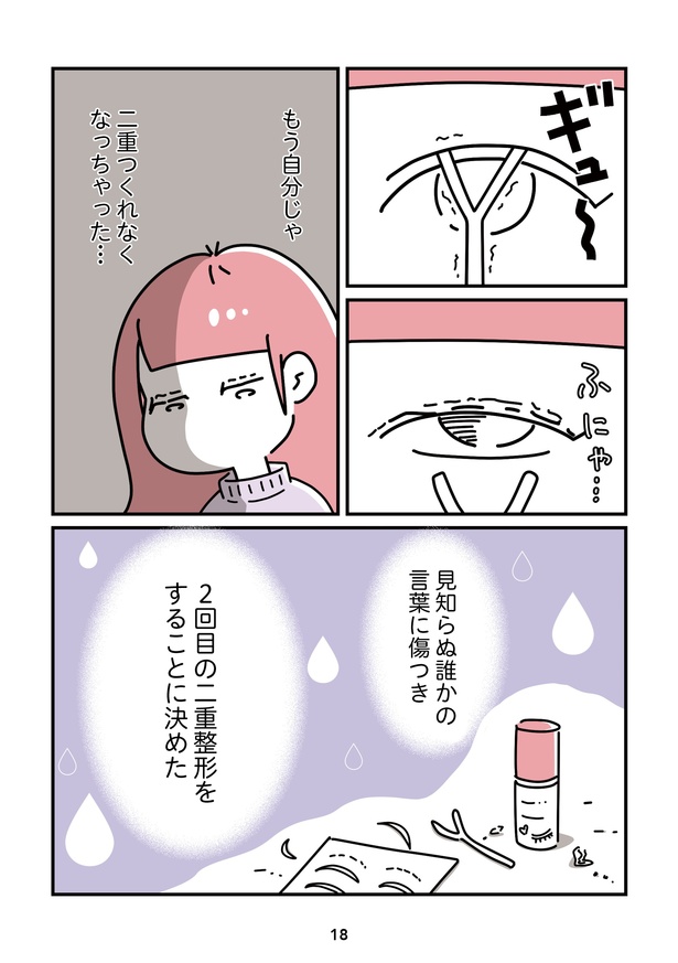 「14歳で整形した私」18