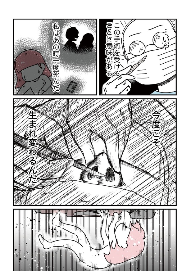 「14歳で整形した私」83