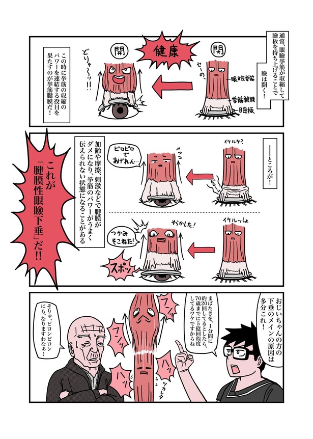 目が重たくてツラい病気『眼瞼下垂』を治したら、色々ラクになったお話09