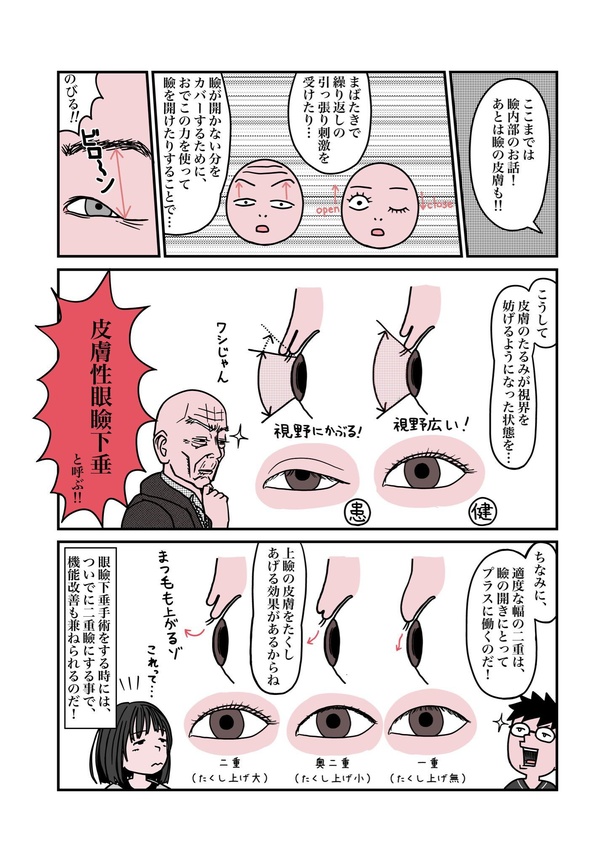 目が重たくてツラい病気『眼瞼下垂』を治したら、色々ラクになったお話10