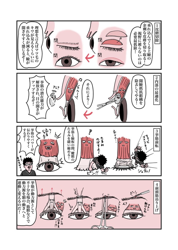 目が重たくてツラい病気『眼瞼下垂』を治したら、色々ラクになったお話12