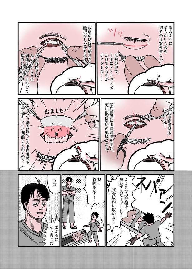 目が重たくてツラい病気『眼瞼下垂』を治したら、色々ラクになったお話18