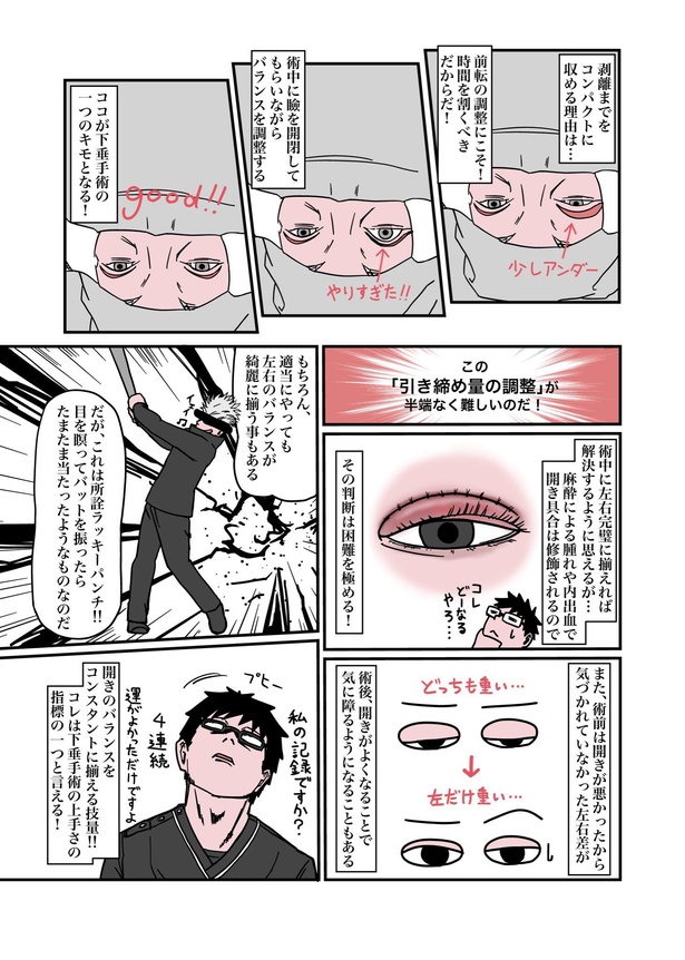 目が重たくてツラい病気『眼瞼下垂』を治したら、色々ラクになったお話19