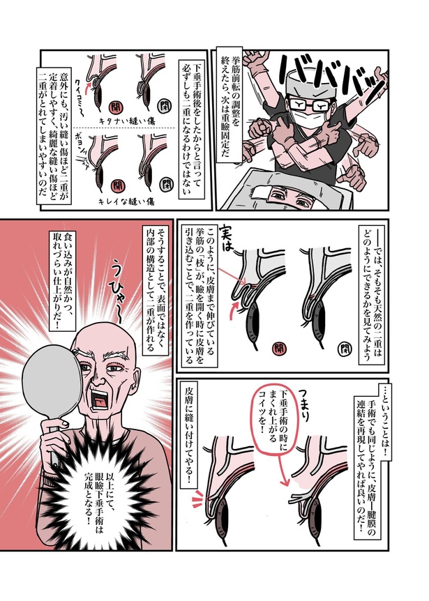 目が重たくてツラい病気『眼瞼下垂』を治したら、色々ラクになったお話20