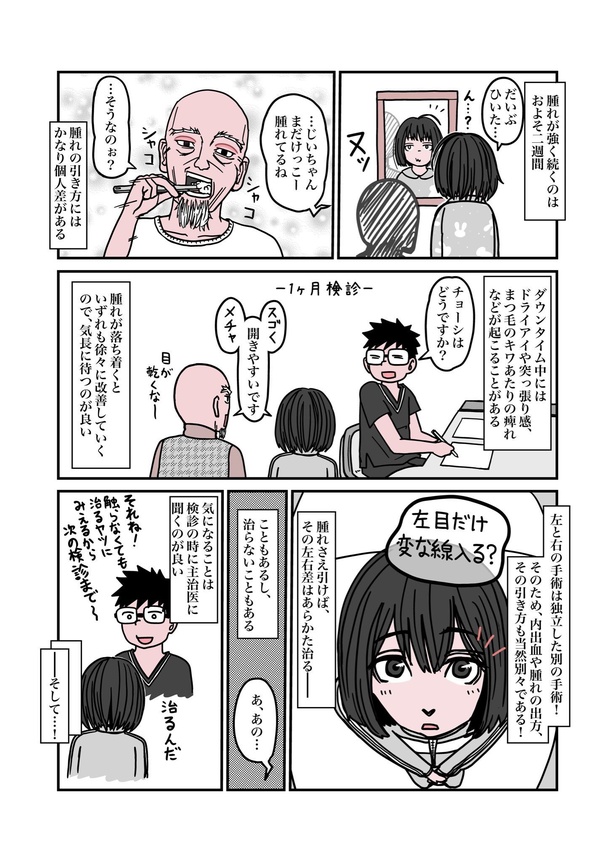 目が重たくてツラい病気『眼瞼下垂』を治したら、色々ラクになったお話25