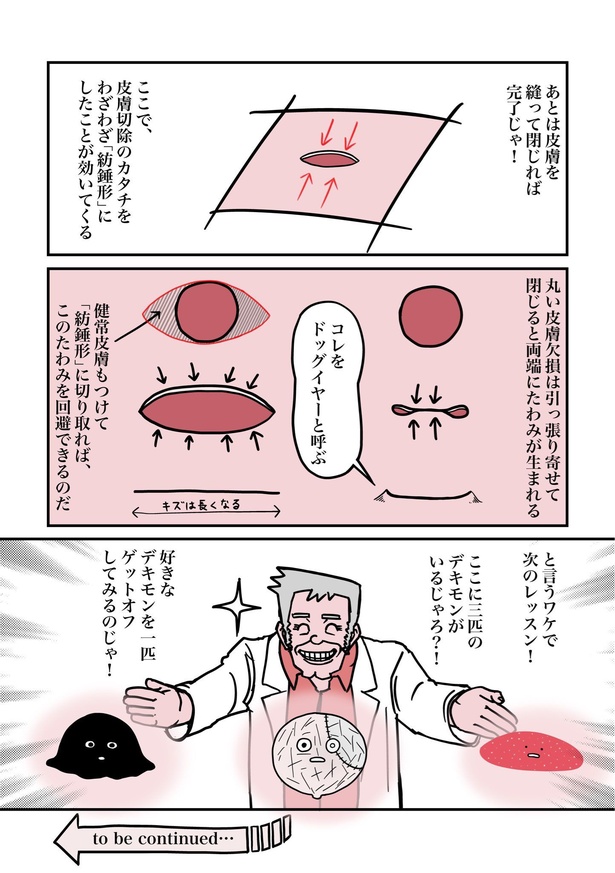 デキモン”を手術で取って治す外科のお話05