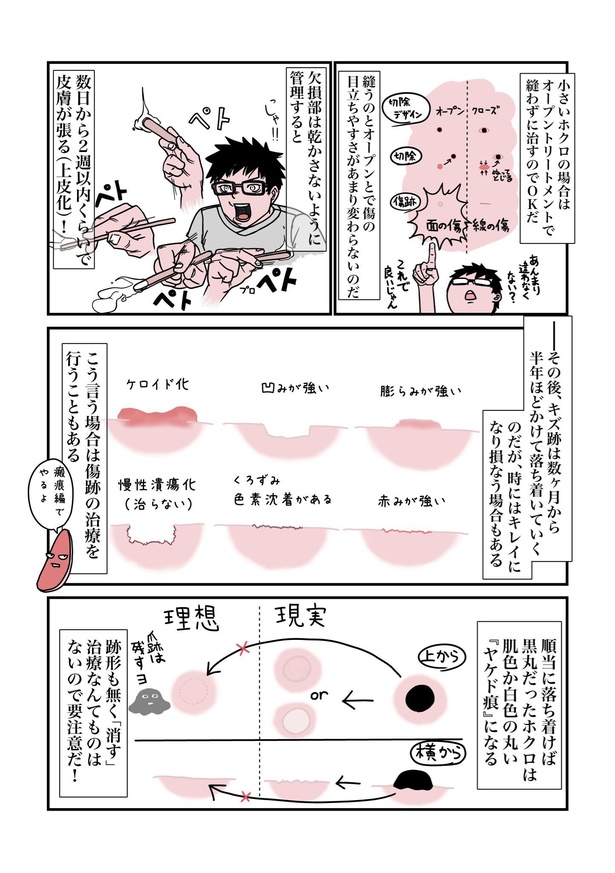 デキモン”を手術で取って治す外科のお話07