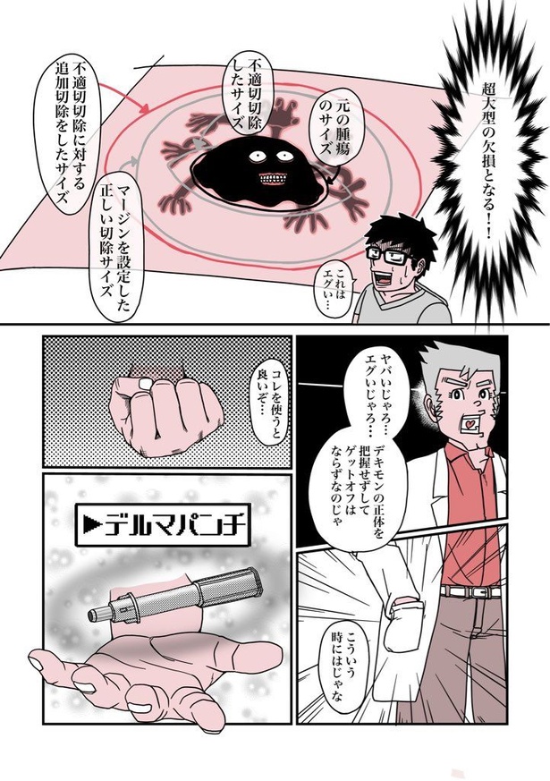 デキモン”を手術で取って治す外科のお話13