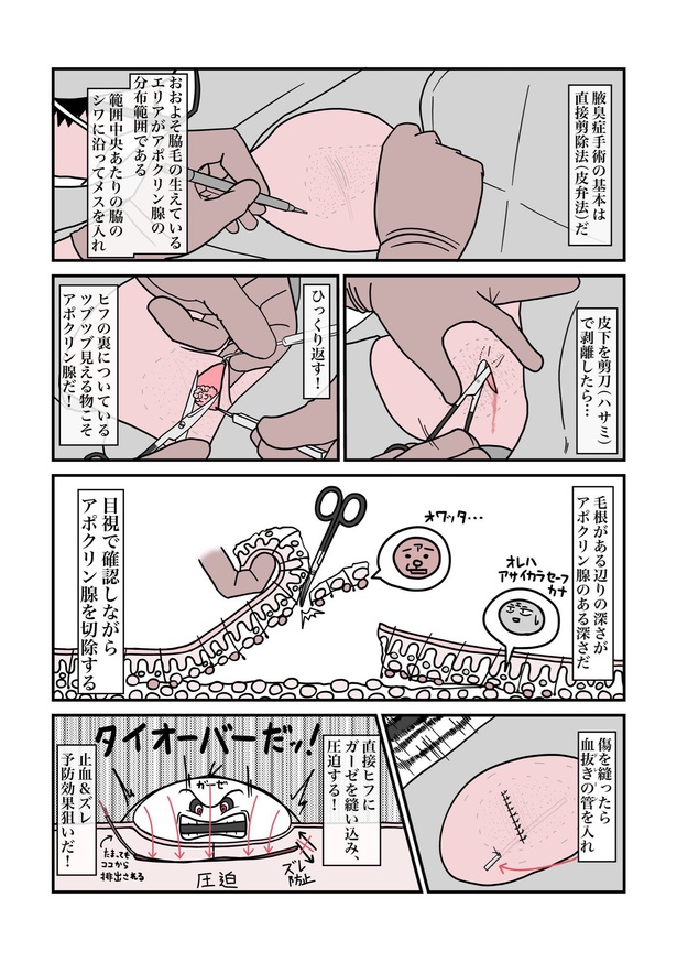 「ワキガ」14