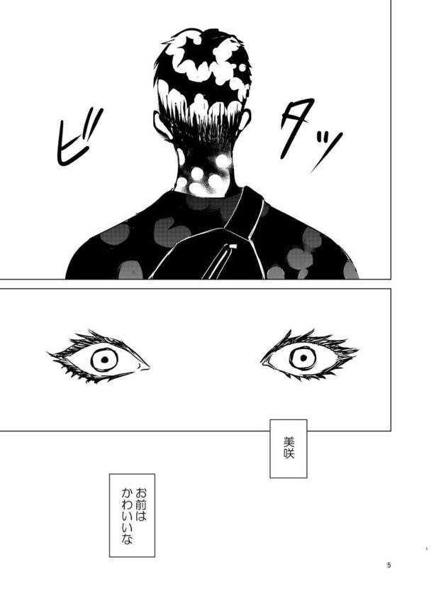 burned04
