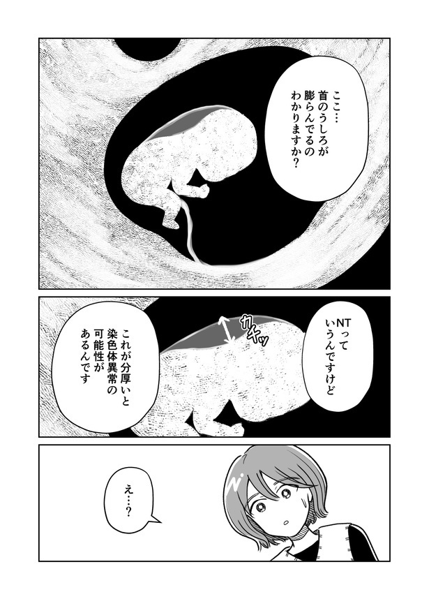 「わたしが選んだ死産の話」2話_005