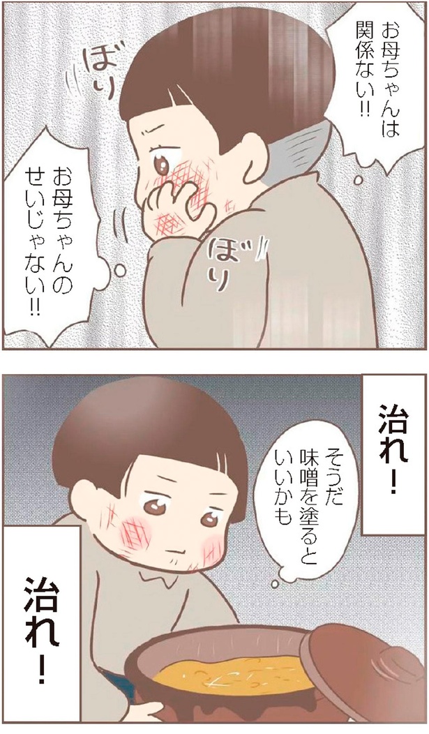 治れ！治れ！ （C）ゆっぺ／KADOKAWA