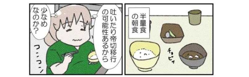 ついにやって来た無痛分娩の日。いつもより半量の朝食を食べて、いざ出産へ！／なかじょんさん傑作選