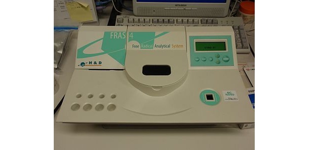 結果は機械ですぐにわかる